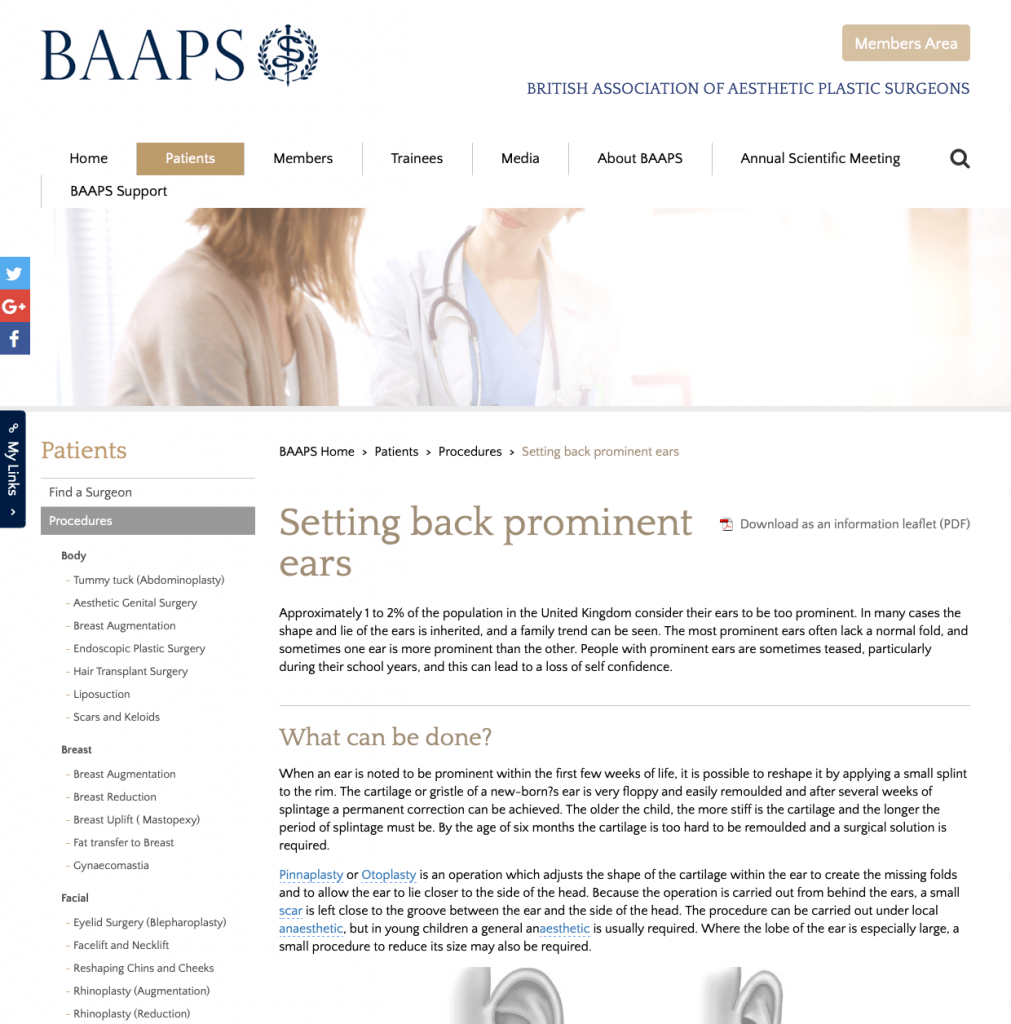 BAAPS Otoplasty website patient guidance David Oliver